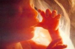 aborto-1_110909 (25k image)