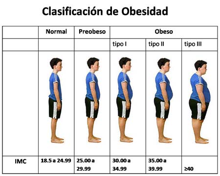 obesidad1_060613 (50k image)